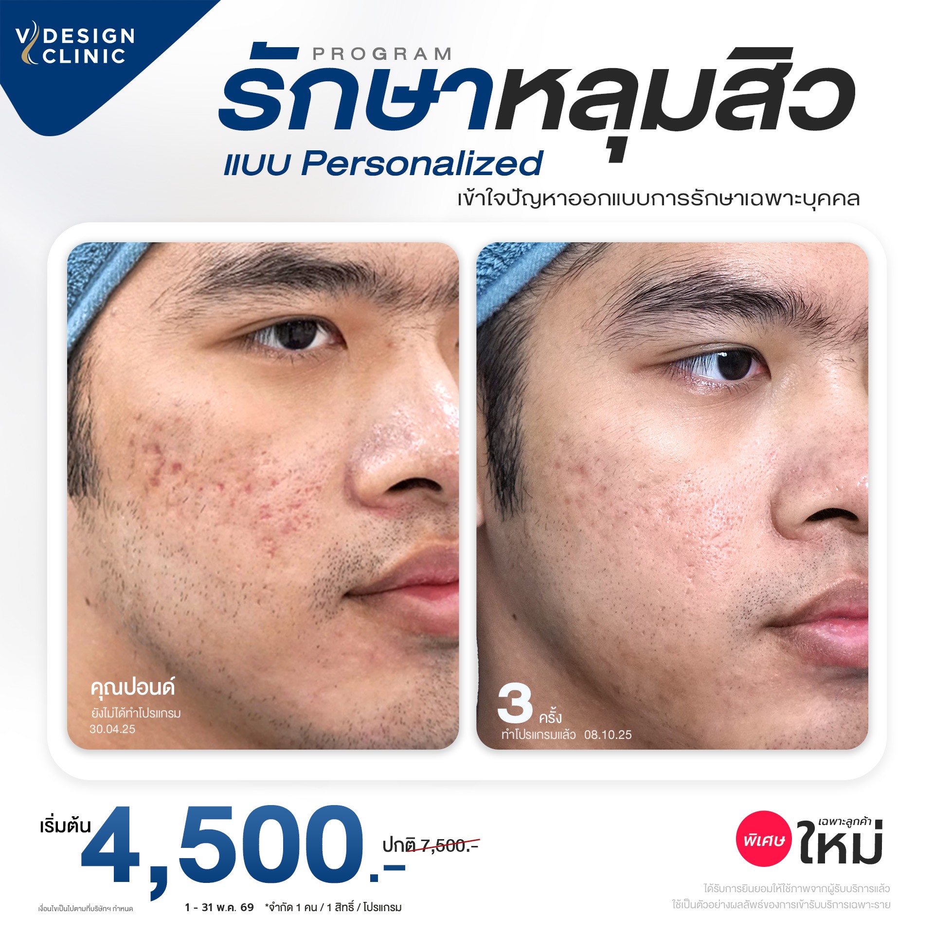 promotion img